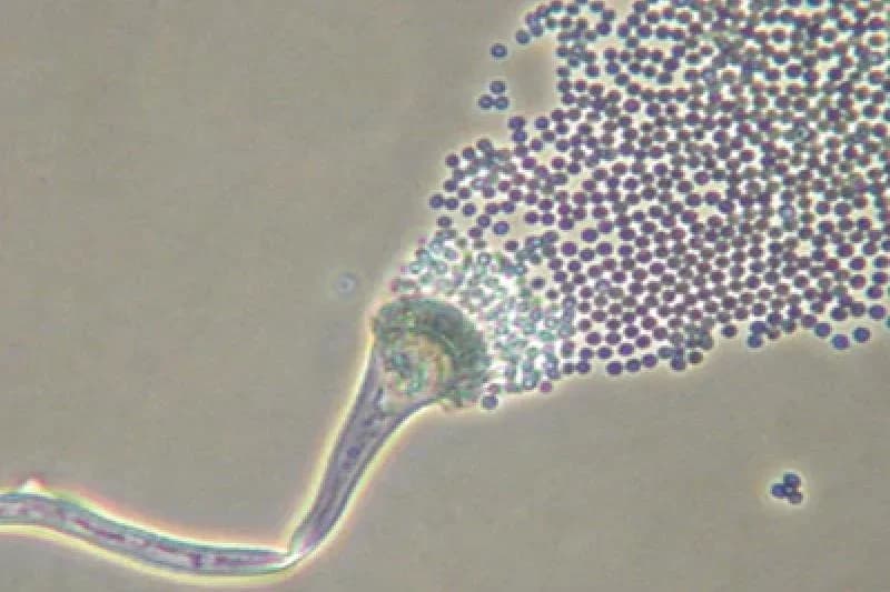 Educational mold microscopy image